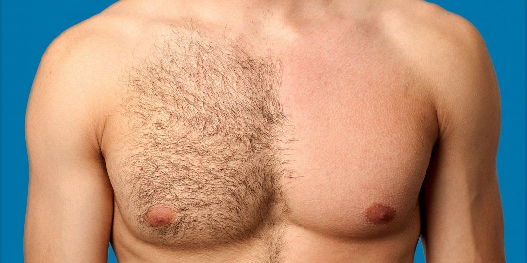 Body hair (Image via Askmen)